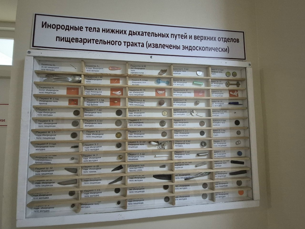 В Саратовской области двухлетний малыш проглотил саморез, а 20-летняя девушка - пирсинг