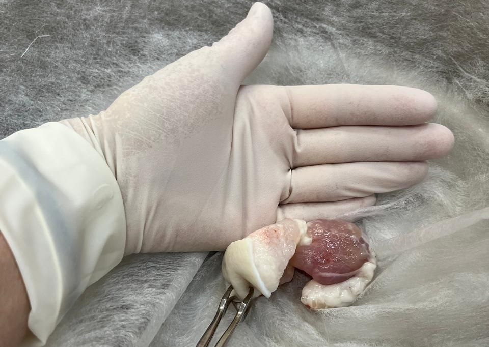 Саратовца едва не погубил застрявший в горле кусок сала