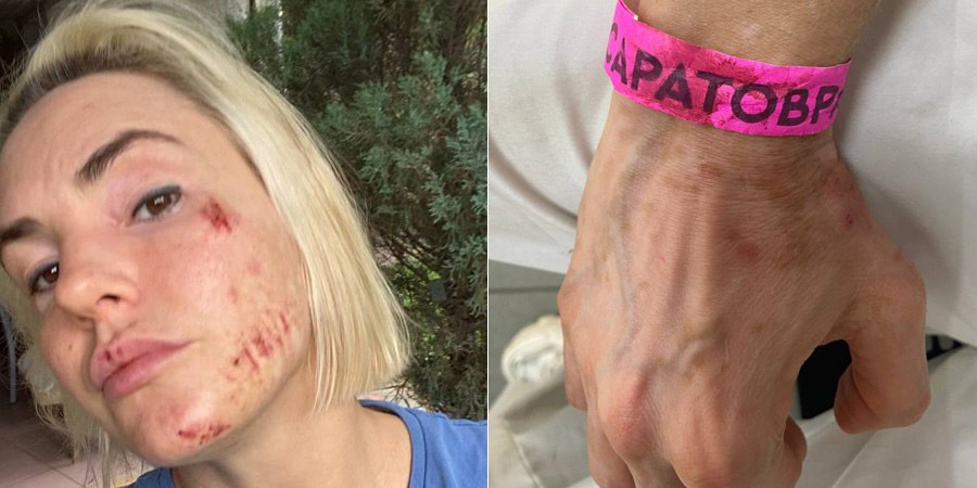 Толпа напала на семейную пару в загородном клубе «Роджер» под Саратовом, начинается суд Толпа напала на семейную пару в загородном клубе «Роджер» под Саратовом, начинается суд